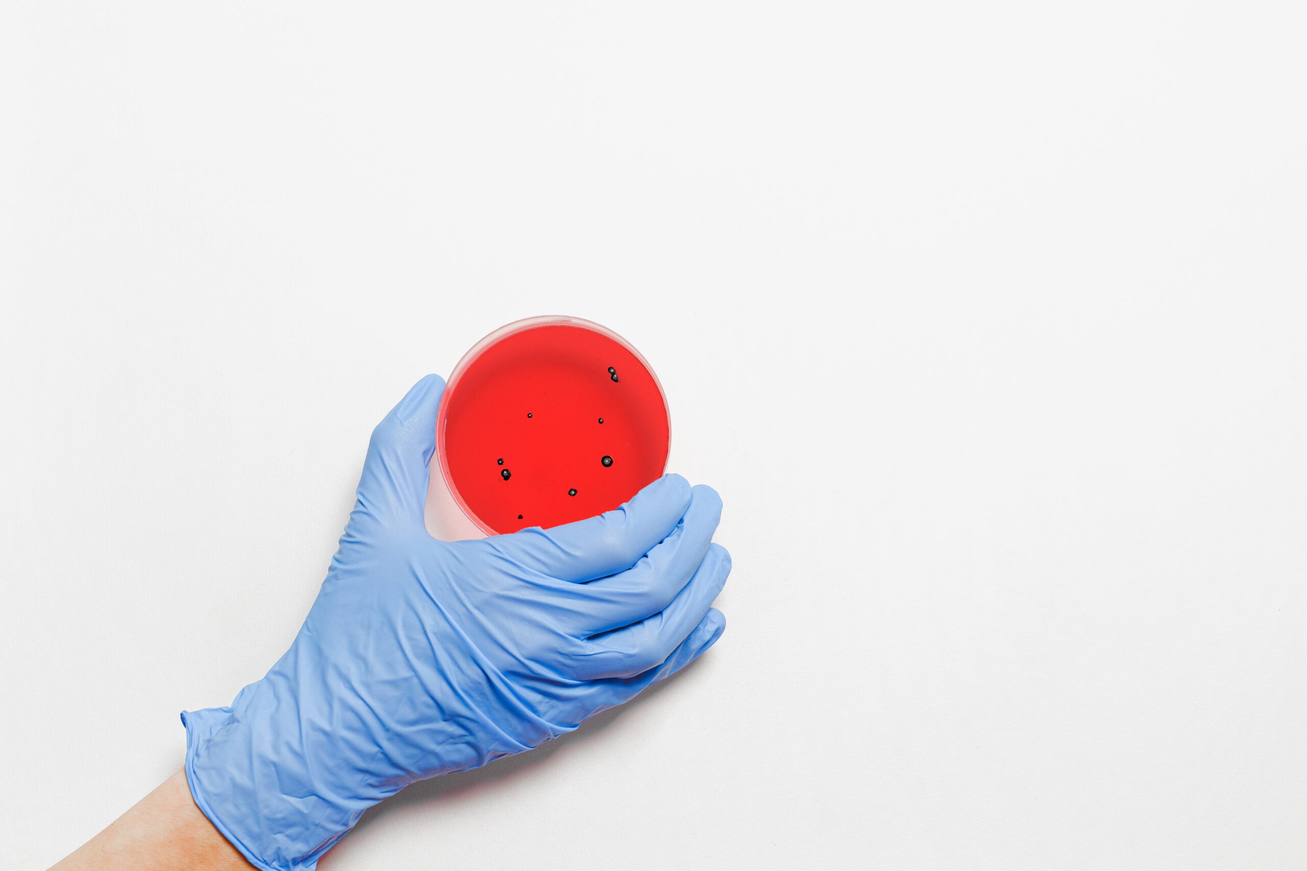 Dłoń w niebieskiej lateksowej rękawiczce trzymająca pojemnik z bakterią yersinia na białym tle